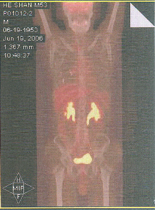 ΢ͼƬ_202011171009115.png